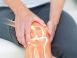 1001 CÂU HỎI THƯỜNG GẶP VỀ ĐAU KHỚP GỐI
